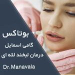 بوتاکس گامی اسمایل و درمان لبخند لثه ای