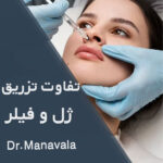 تفاوت بین ژل و فیلر