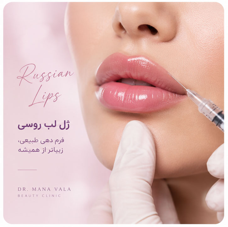 ژل لب روسی در اهواز